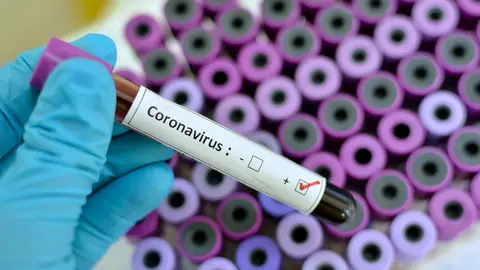 Blood sample with respiratory coronavirus positive