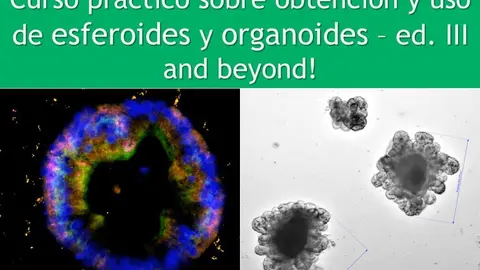 "Curso Pr&aacute;ctico sobre obtenci&oacute;n y uso de esferoides y organoides" Universidad de Le&oacute;n